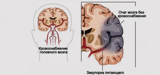 Медицинска история в неврологията