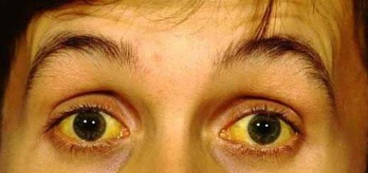 Причины желтого цвета лица: возможные заболевания и их лечение в домашних условиях